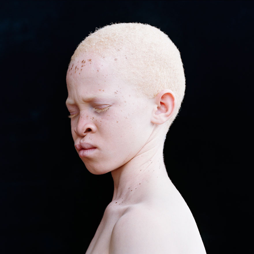 20 неземных людей-альбиносов, поражающих своей внешностью.