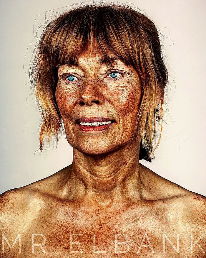 люди с веснушками, Брок Элбанк, Brock Elbank