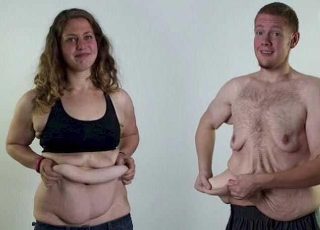 На двоих эта пара весила 320 кг, но они не только похудели в половину этого веса, но и избавиться от лишней кожи пара похудела в половину веса, пара весила 320 кг на двоих, пара до и после похудения