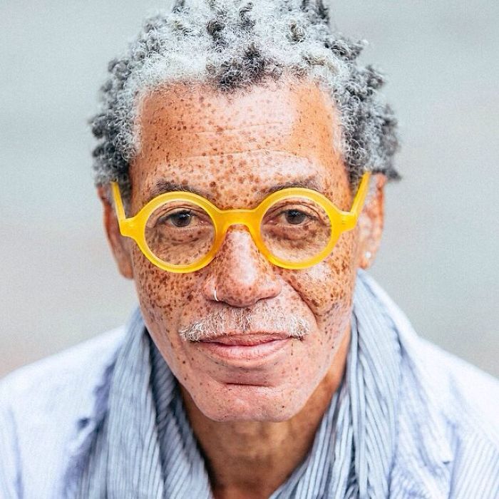 люди с веснушками, красота людей с веснушками