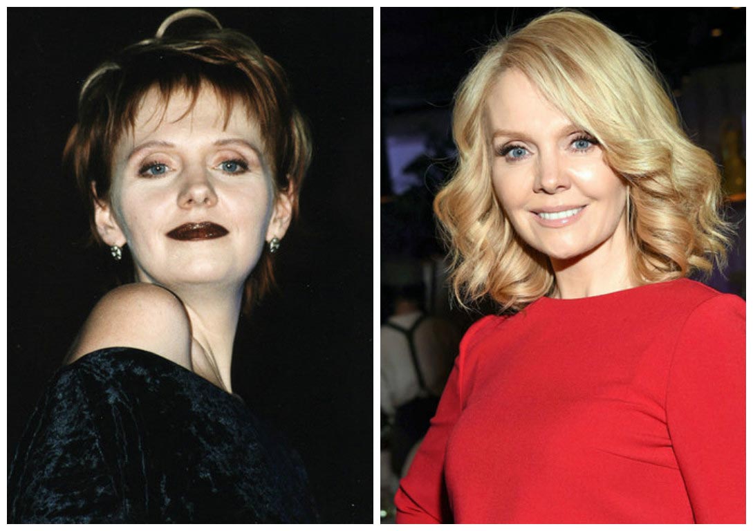 российские звёзды которые изменились до неузнаваемости, пластические операции звёзд 