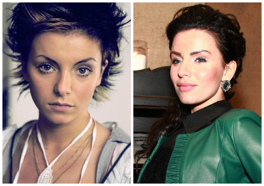 российские звёзды которые изменились до неузнаваемости, пластические операции звёзд 