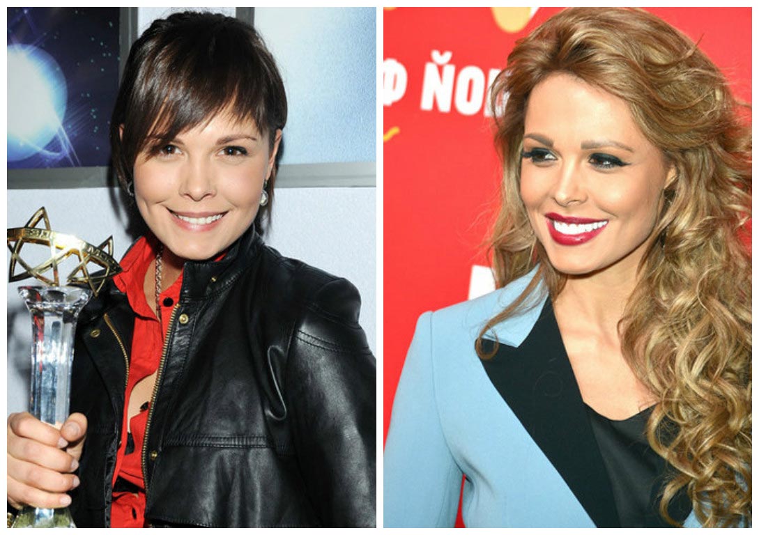 российские звёзды которые изменились до неузнаваемости, пластические операции звёзд 