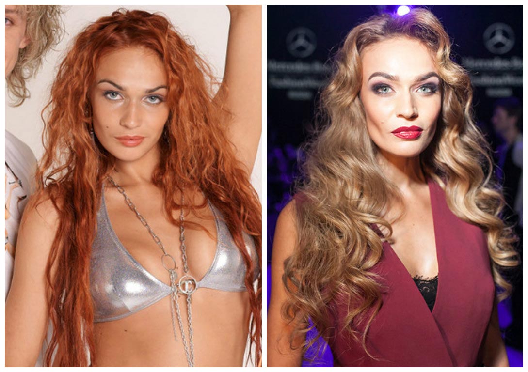 российские звёзды которые изменились до неузнаваемости, пластические операции звёзд 