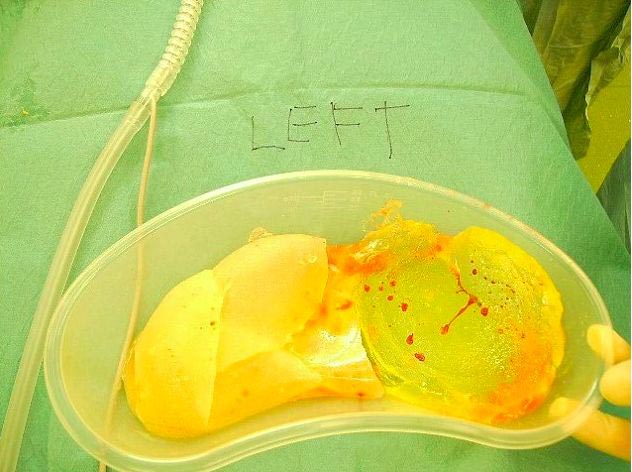 Би Камерон, Bee Cameron, потратила 100000 долларов на превращение в Джессику Рэббит, пластические операции на 100000 долларов