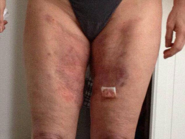 Би Камерон, Bee Cameron, потратила 100000 долларов на превращение в Джессику Рэббит, пластические операции на 100000 долларов