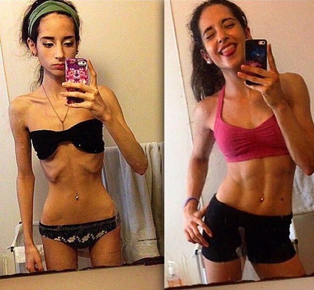 из анорексички в фитнес модель, анорексичка накачала мышцы, больная анорексией накачала мышцы, Сара Рамадан, Sarah Ramadan