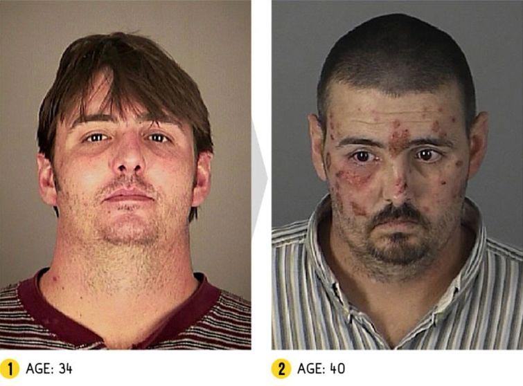 Лица до и после метамфетамина, люди до и после метамфетамина