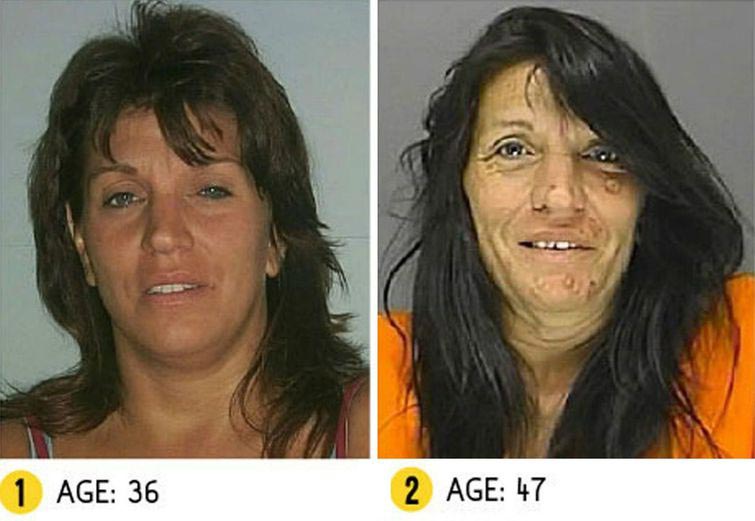 Лица до и после метамфетамина, люди до и после метамфетамина