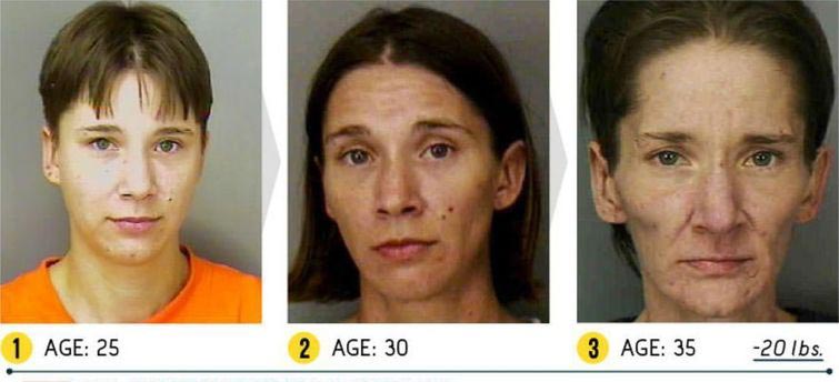 Лица до и после метамфетамина, люди до и после метамфетамина