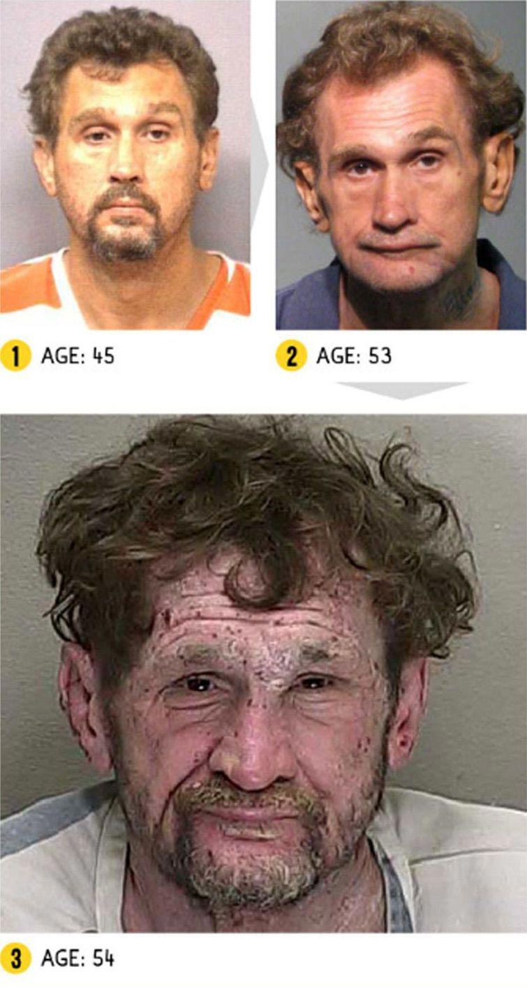 Лица до и после метамфетамина, люди до и после метамфетамина