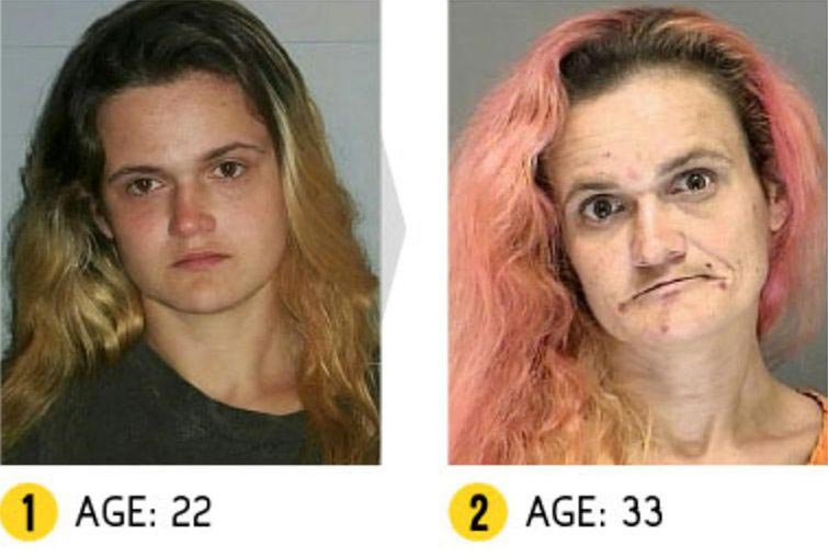 Лица до и после метамфетамина, люди до и после метамфетамина