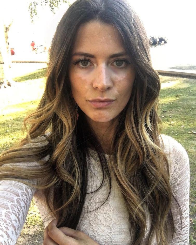 Бреанну Райс, Breanne Rice, прятала витилиго под макияжем, модель показала настоящее лицо, модель витилиго макияж