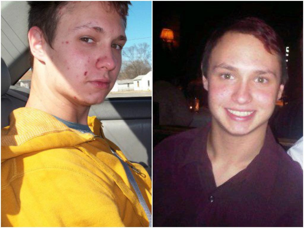 которые бросили принимать наркотики, люди до и после наркозависимости 