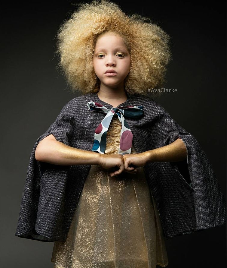 Ава Кларк, Ava Clarke, девочка-альбинос ставшая моделью