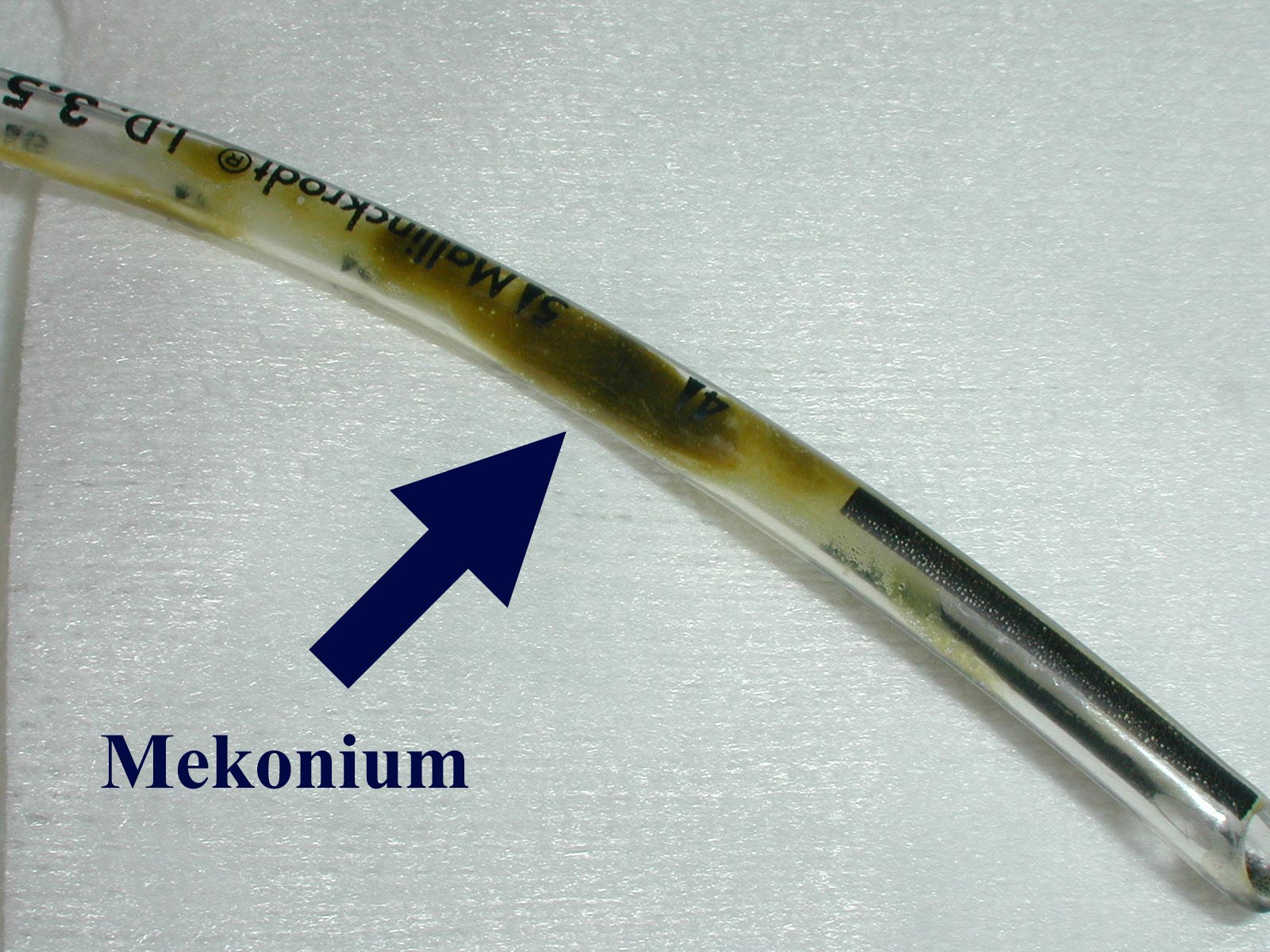 факты о человеке, познавательные факты о человеческом теле