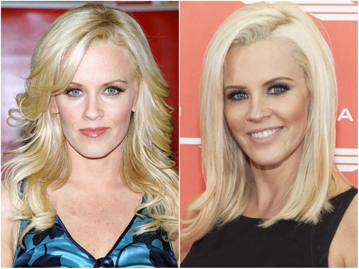 знаменитости коловшие себе ботокс, неудачная пластика знаменитостей