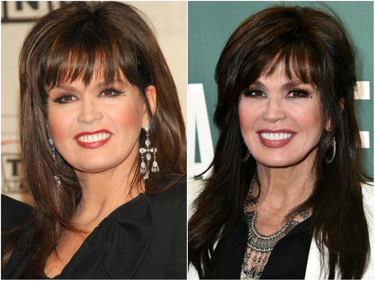 Did marie osmond have a nose job