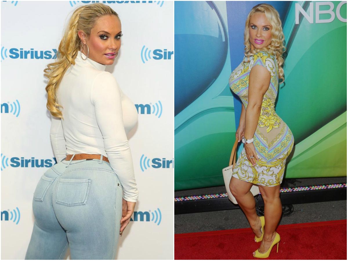 звёзды с большими ягодицами, силиконовые ягодицы звёзд