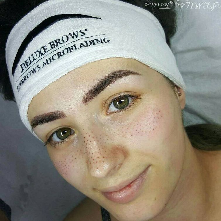 татуированные веснушки, tattoo Freckles