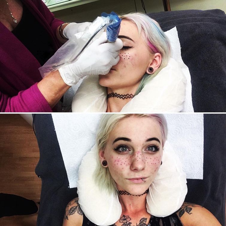татуированные веснушки, tattoo Freckles
