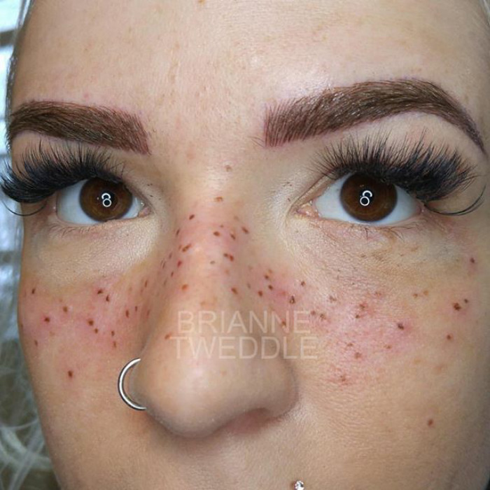 татуированные веснушки, tattoo Freckles