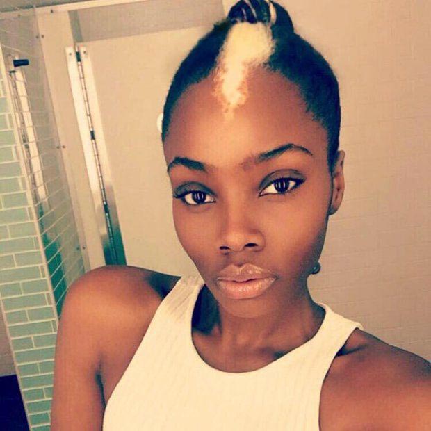 Ребекка Хеккард, девушку обзывали скунсом, выросла стала моделью, 