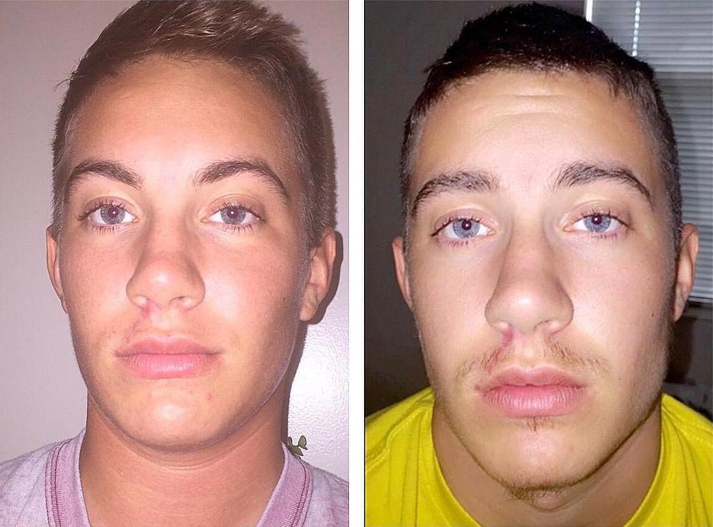 транссексуал до и после, Джейми Уилсон, Jaimie Wilson, превращение из девушки в парня