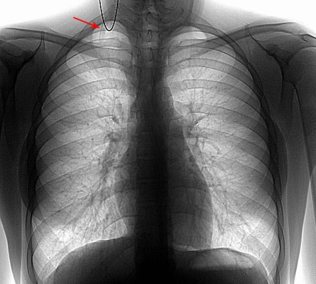 факты о теле, факты о человеческом теле