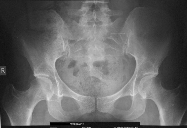 факты о теле, факты о человеческом теле