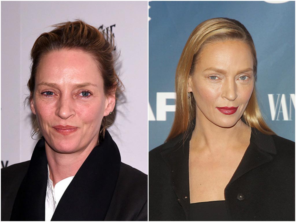 10 звёзд Голливуда, которым явно не повезло с пластическим хирургом неудачные пластические операции звёзд, звёзды с неудачной пластикой