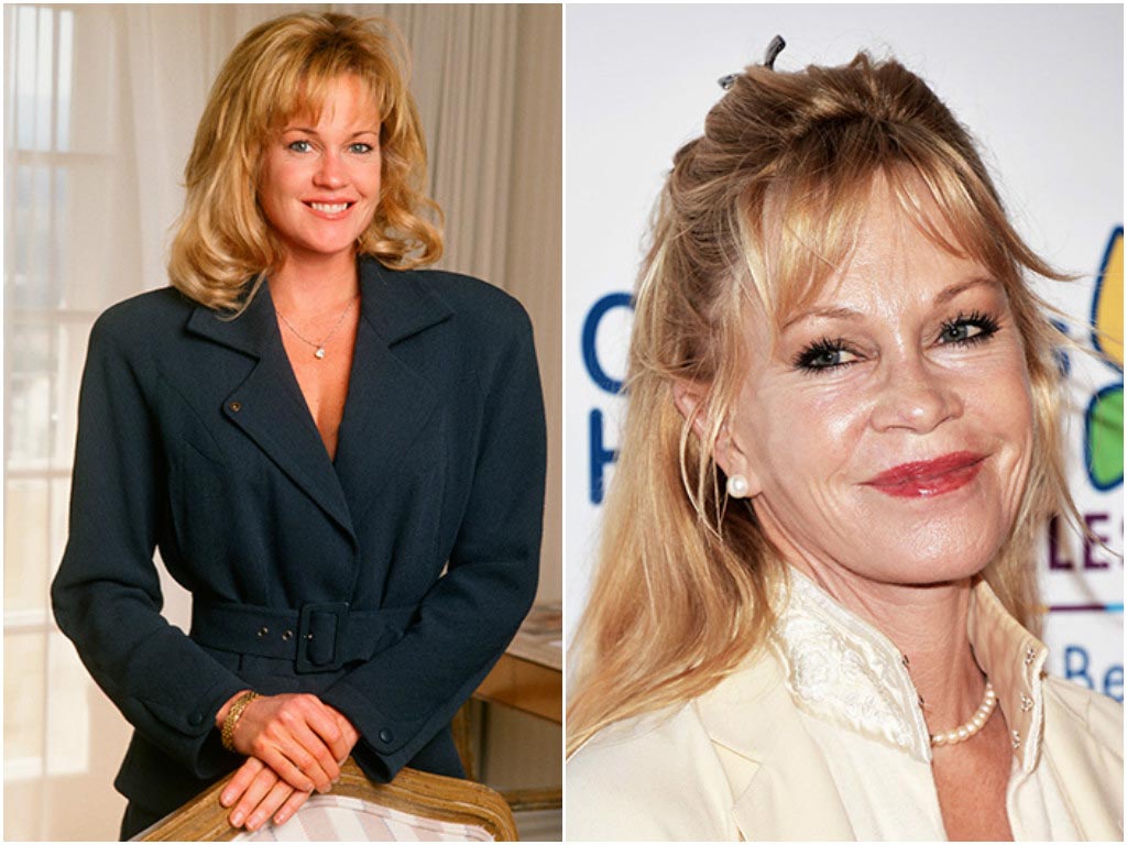 10 звёзд Голливуда, которым явно не повезло с пластическим хирургом неудачные пластические операции звёзд, звёзды с неудачной пластикой