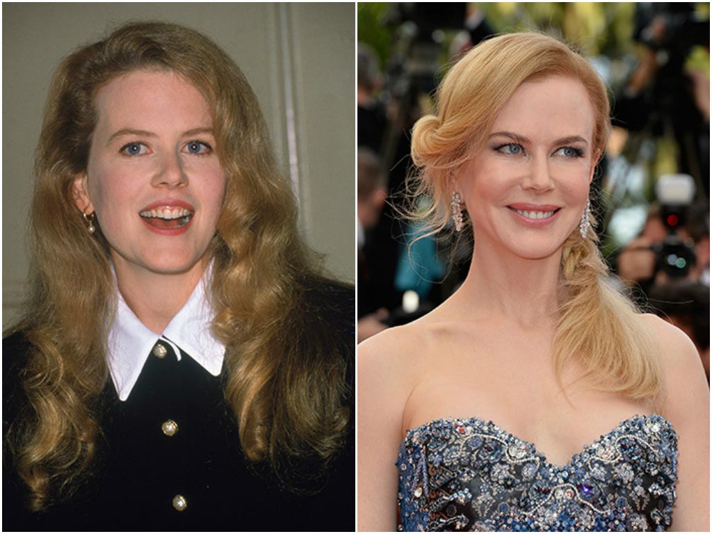 10 звёзд Голливуда, которым явно не повезло с пластическим хирургом неудачные пластические операции звёзд, звёзды с неудачной пластикой