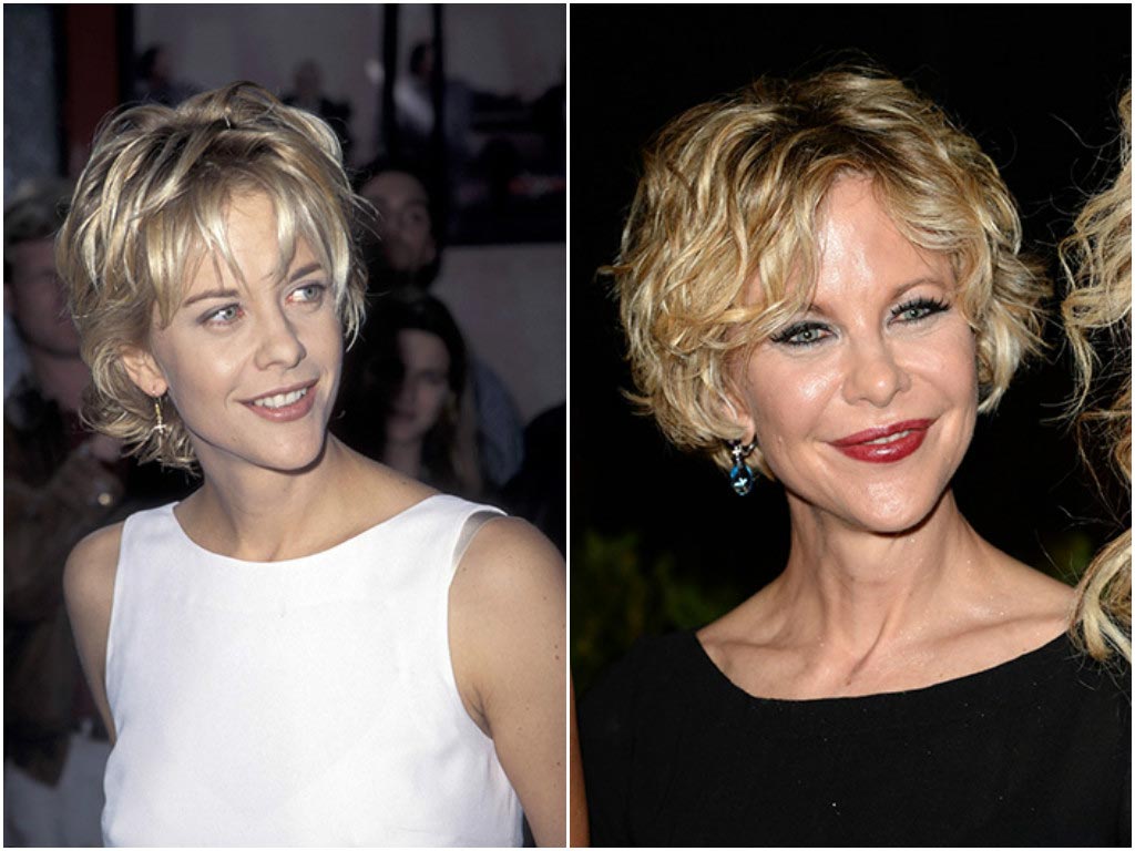 10 звёзд Голливуда, которым явно не повезло с пластическим хирургом неудачные пластические операции звёзд, звёзды с неудачной пластикой