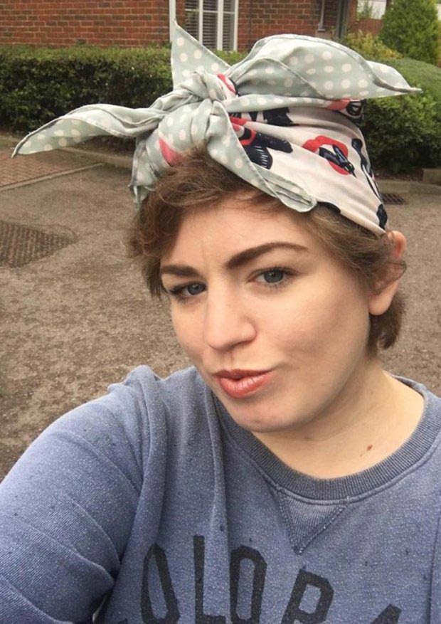 химический ожог покраска волос, красила волосы химический ожог, красила волосы осталась лысой