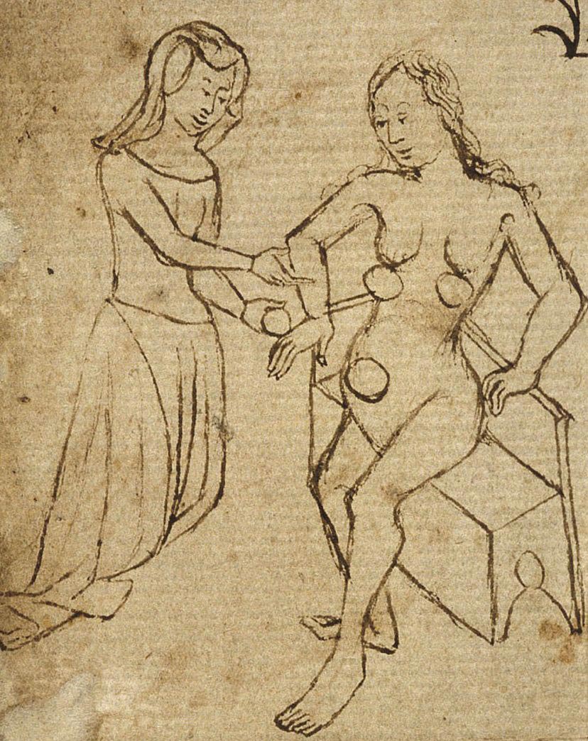 безумные методы контрацепции, методы контрацепции из прошлого 