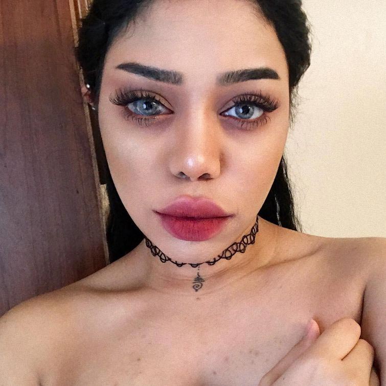 родинка на глазу, невус на глазу, Соня Лесли, Sonia Leslie