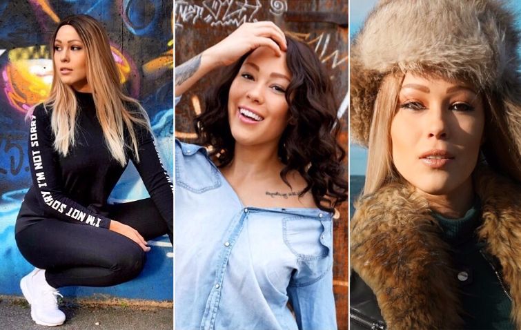 лысая модель, модель с алопецией, Тереза Хансон, Therese Hansson