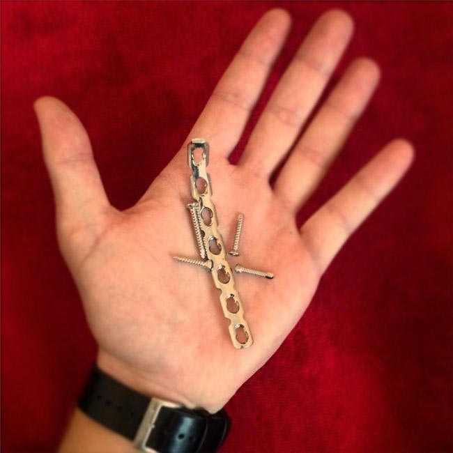 кольцо их хирургической пластины, пластина в ключице кольцо