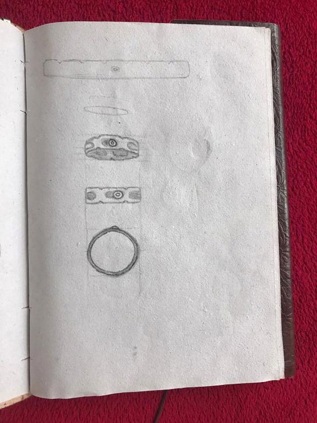 кольцо их хирургической пластины, пластина в ключице кольцо