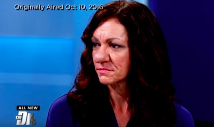 ринофима до и после, тяжёлая форма риноцеи, Памела Ичард, Pamela Ichard, ринофима у женщин