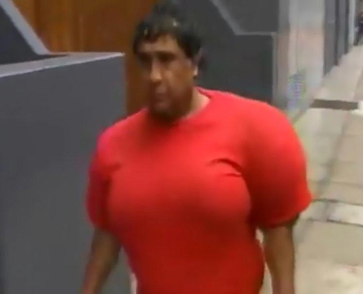 декомпрессионная болезнь, декомпрессионная болезнь симптомы, декомпрессионная болезнь последствия