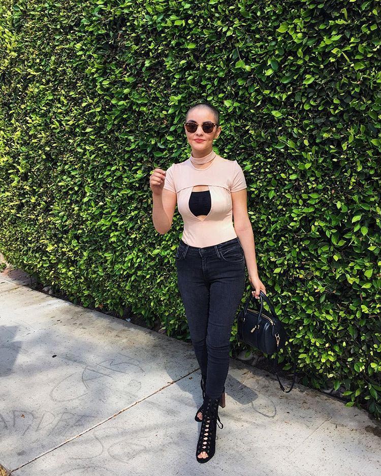 Андреа Сьерра Салазар, потеряла волосы рак, фотосессия потеряла волосы из-за болезни