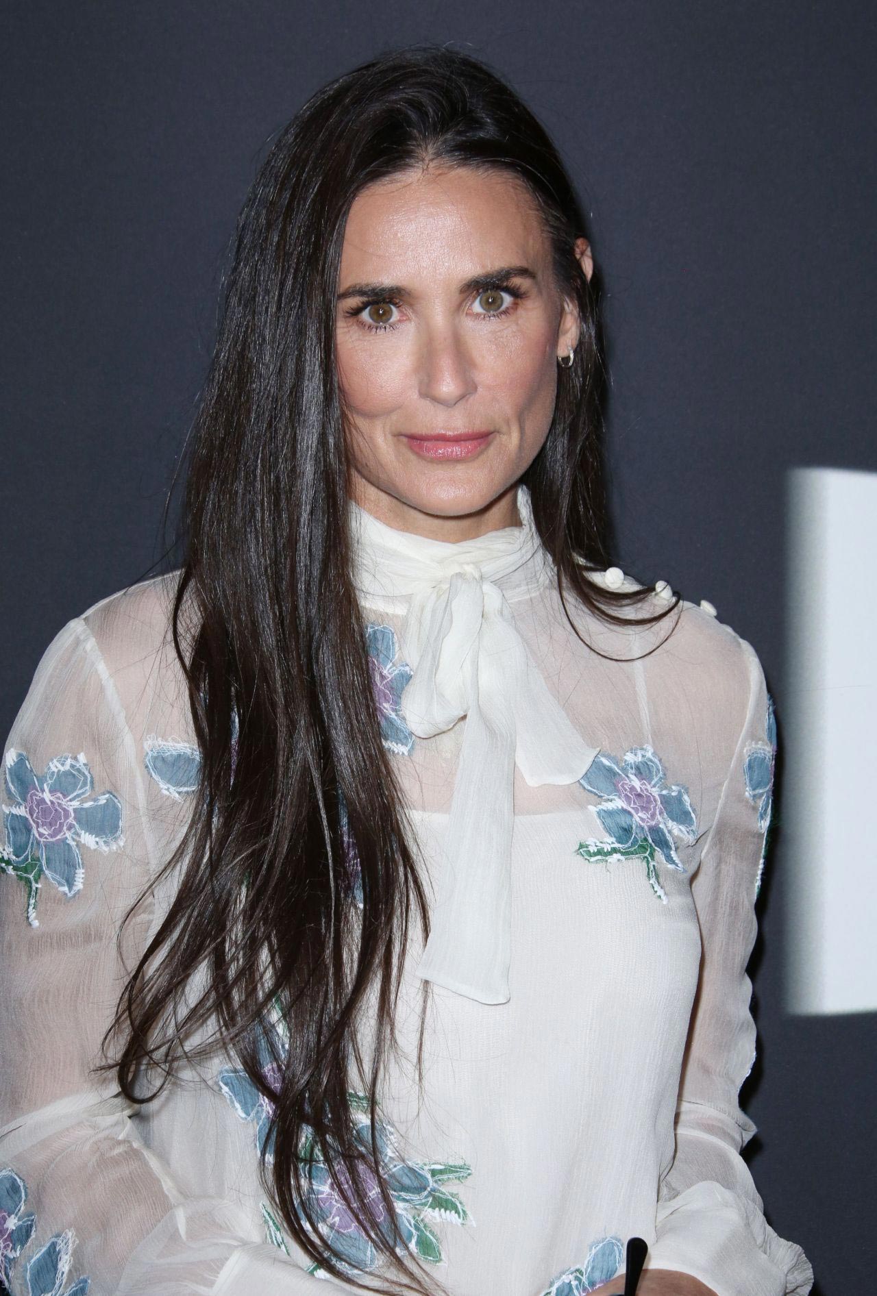 знаменитости и пластические операции, знаменитости сделавшие подтяжку