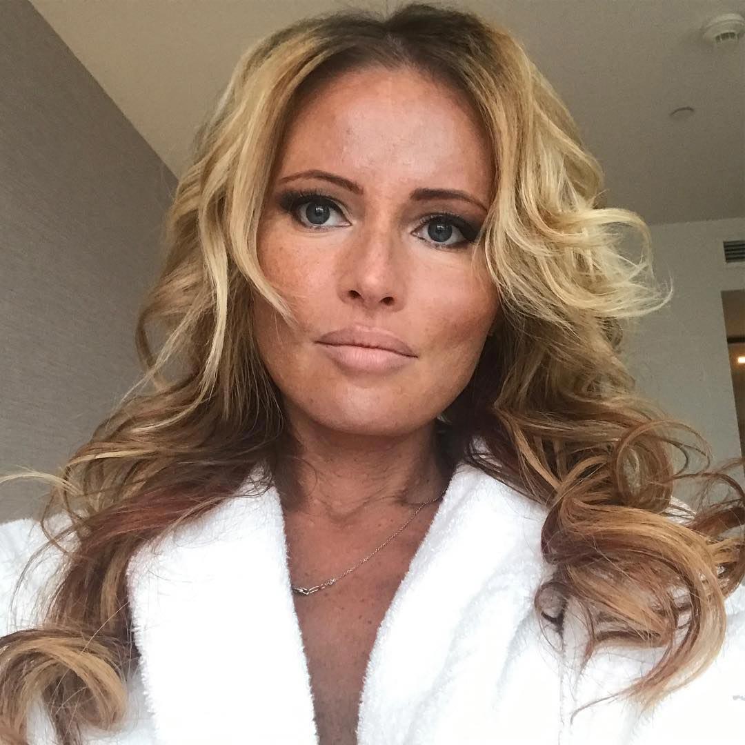 знаменитости и пластические операции, знаменитости сделавшие подтяжку