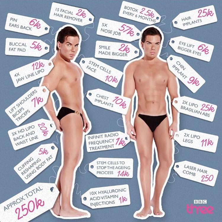 Родриго Алвес, Родриго Алвес до и после, родриго алвес до пластики, родриго алвес до операций