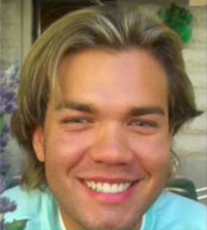 Родриго Алвес, Родриго Алвес до и после, родриго алвес до пластики, родриго алвес до операций