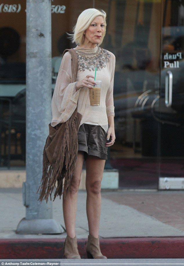 звёзды которым не к лицу худоба, сильно похудевшие звёзды