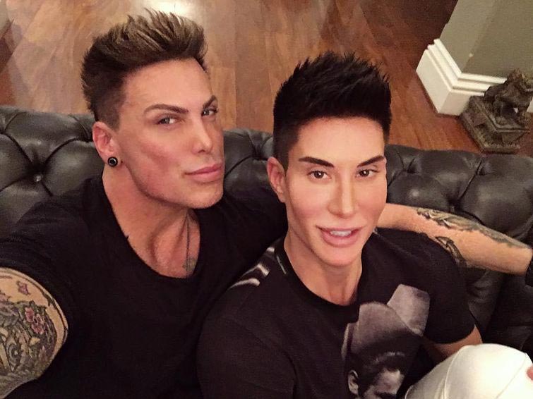 Невен Сиганович, постоянная эрекция после ринопластики, эрекция после анестезии, приапизм