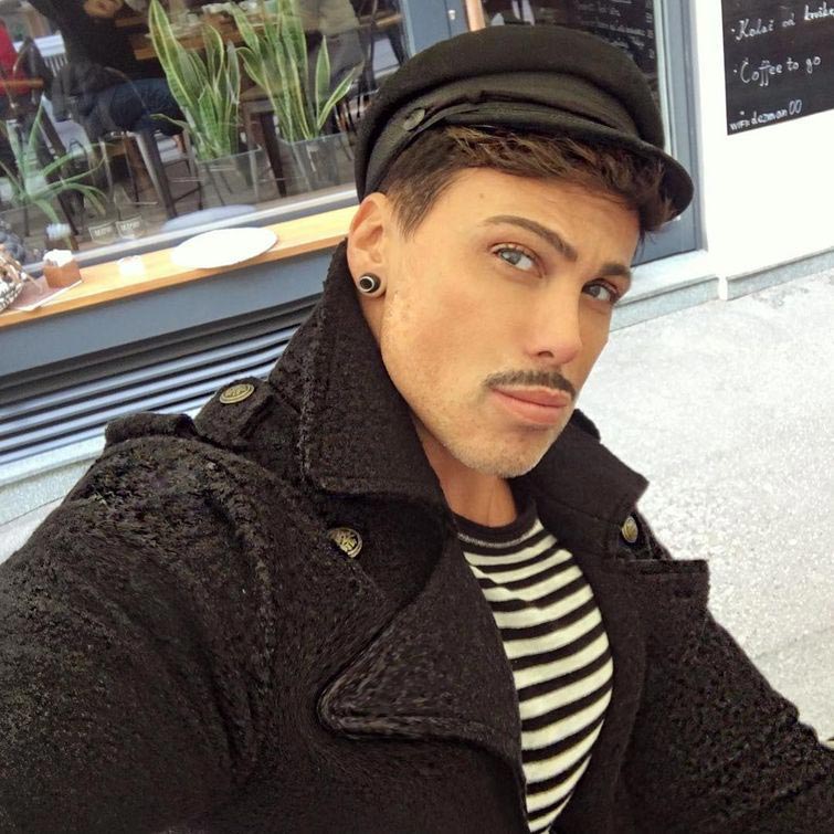 Невен Сиганович, постоянная эрекция после ринопластики, эрекция после анестезии, приапизм